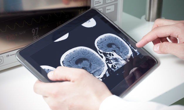 L’impact de l’intelligence artificielle et du deep-learning sur la radiologie